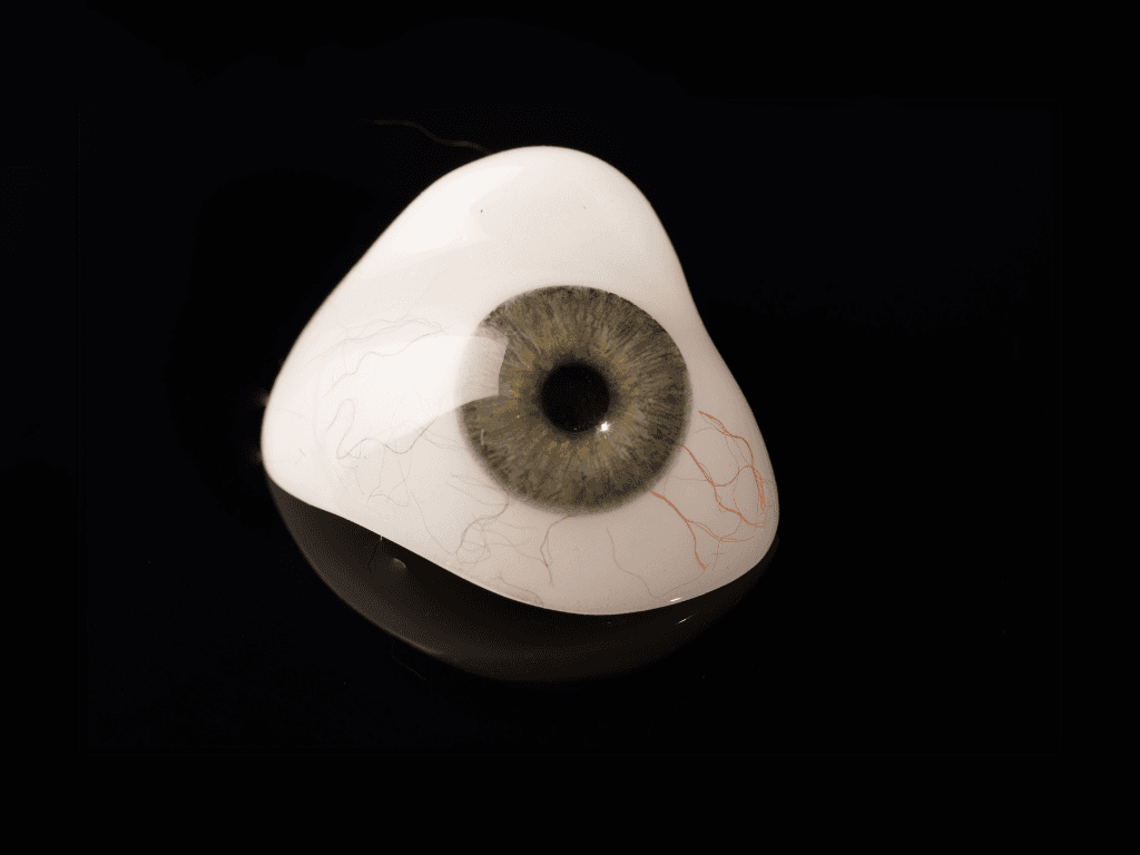Prótesis oculares